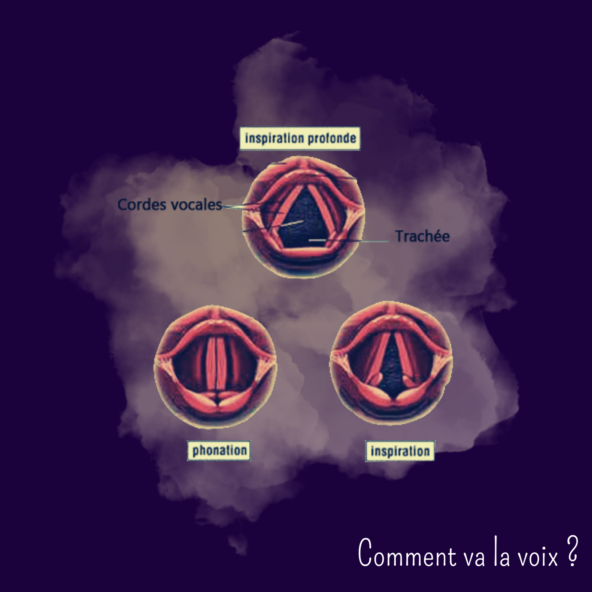 Comment va la voix 4